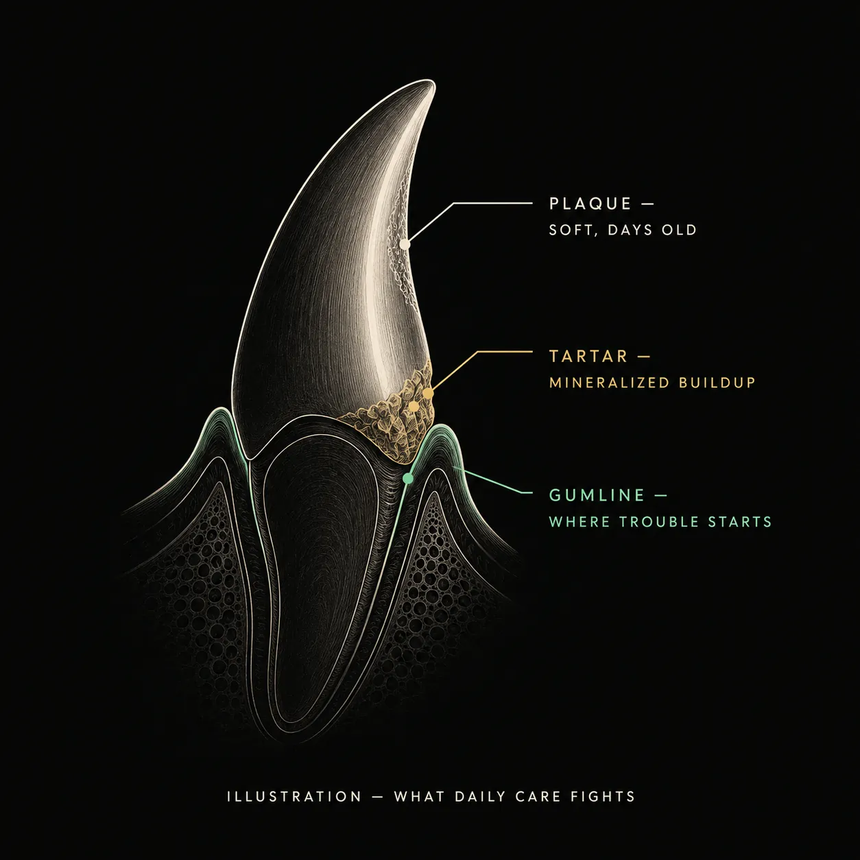 Illustration of a dog tooth showing soft days-old plaque, mineralized tartar, and the gumline where trouble starts: what daily care fights